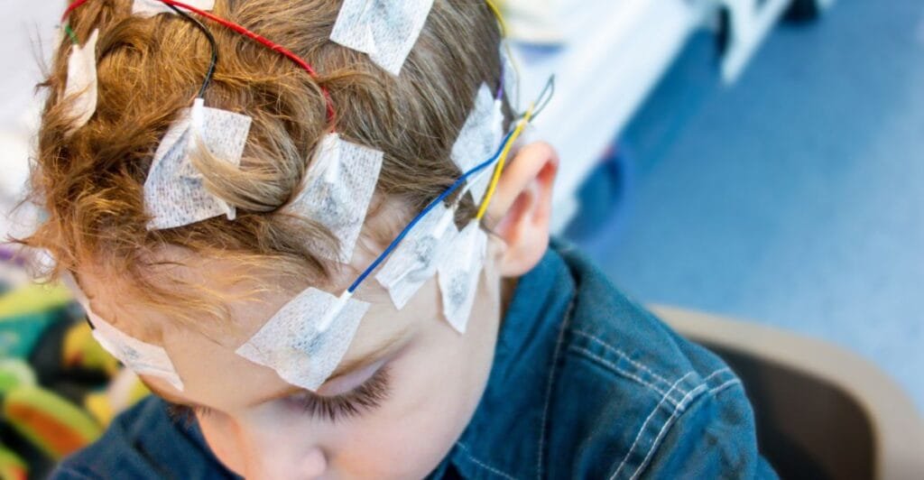 Quels sont les symptômes de l'épilepsie ?